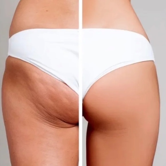 🎁 (2/$35) Truly Anti Cellulite Body Mask (NIB) - Picture 10 of 15